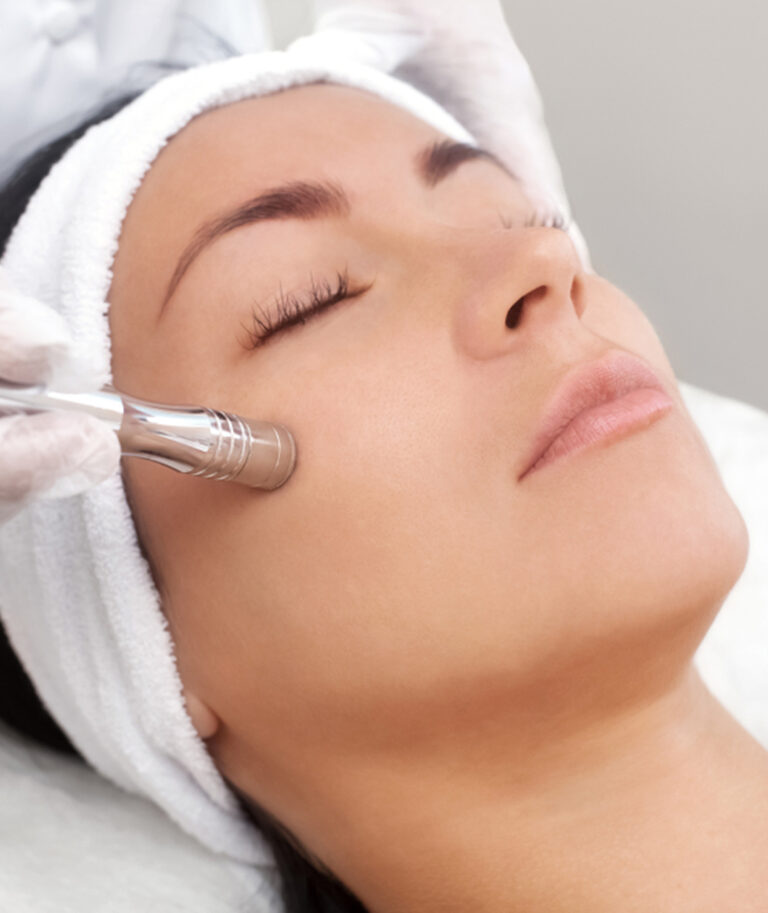 Durability of microdermabrasion