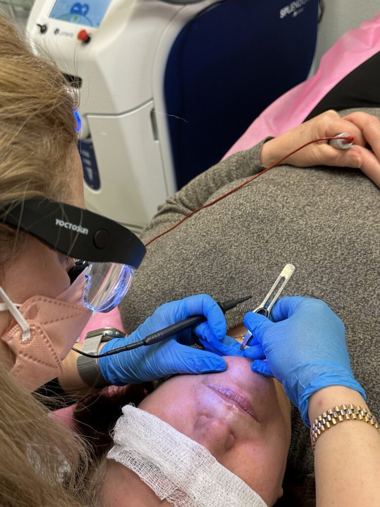 Aesthetician performing electrolysis hair removal on a client’ , showcasing the permanent hair removal process.