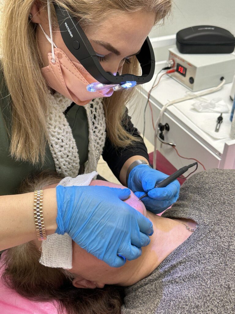 Certified electrologist Nasrin performs electrolysis hair removal on a client’s face in a clean, professional treatment room at Aesthetician Nasrin in Plano, Dallas, using advanced equipment for safe, permanent results.