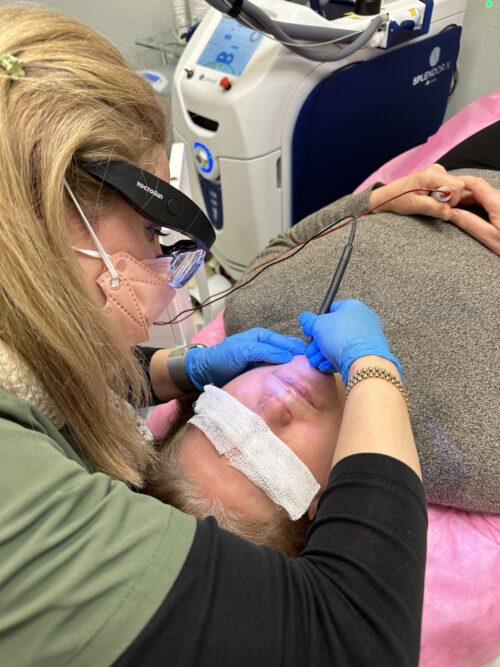 Professional electrolysis in Plano: licensed electrologist performing electrolysis on a client in a sterile clinic at Aesthetician Nasrin.

