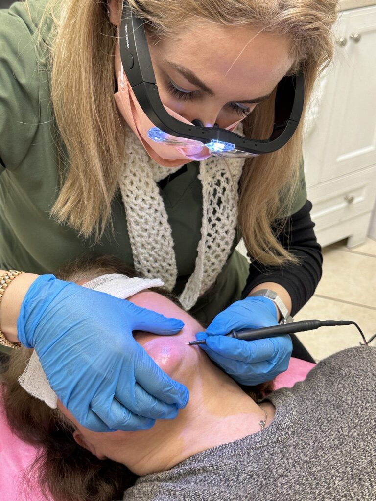 A professional performing electrolysis on a client’s skin for permanent hair removal.